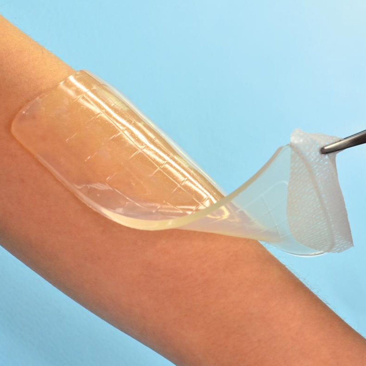 Hydrogel Dressing