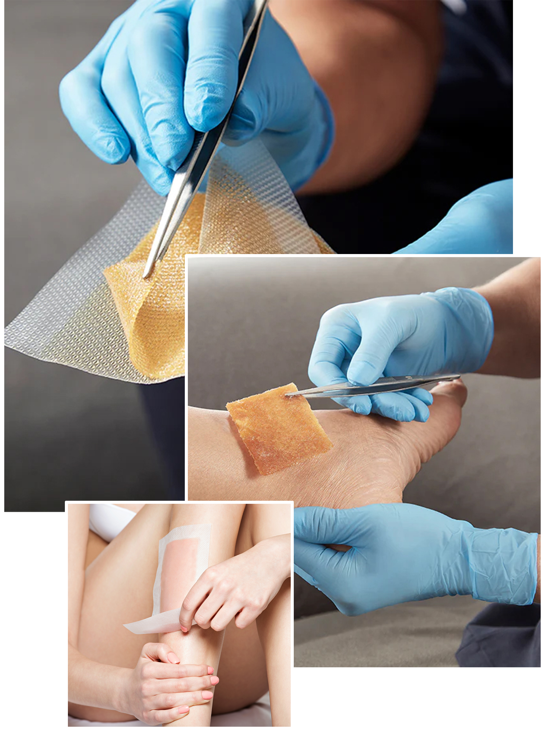 About Wound & Burn Care
